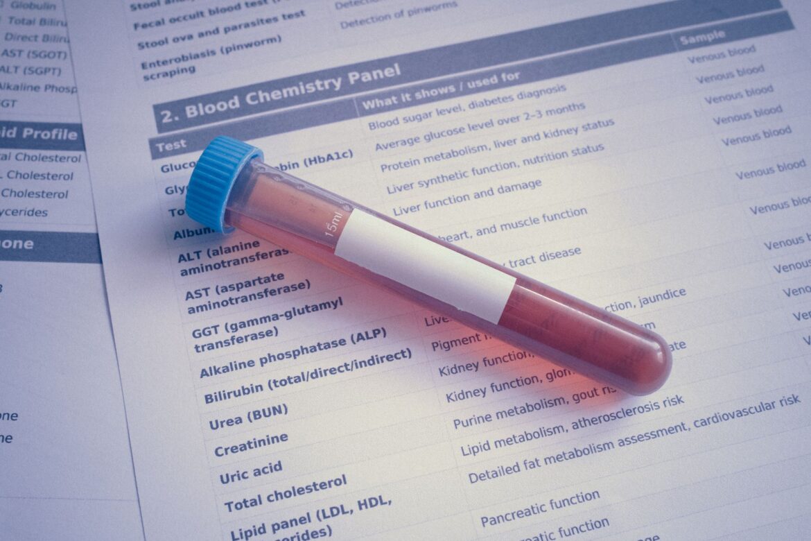 A blood sample tube placed on a chemistry panel document, showcasing medical testing.